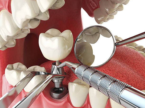 Best Broken Tooth Emergency  in Winfield, AL